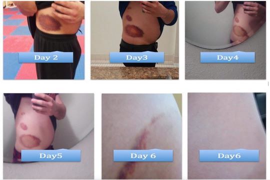 X-Jow: Natural Pain Relief Gel for Muscle and Joint Pain/ Sports Injuries. (4 oz)